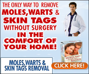 Home Remedies For Warts