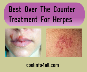 Best Over The Counter Treatment For Herpes