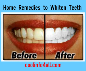 Home Remedies to Whiten Teeth