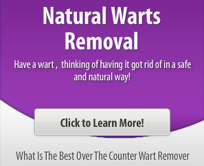 What Is The Best Over The Counter Wart Remover