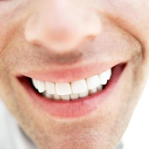 What Is The Best Over The Counter Teeth Whitening Product3