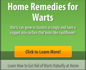 Home Remedies For Warts