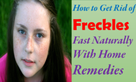 How to Get Rid of Freckles On Face Fast Naturally Permanently At Home With Home Remedies